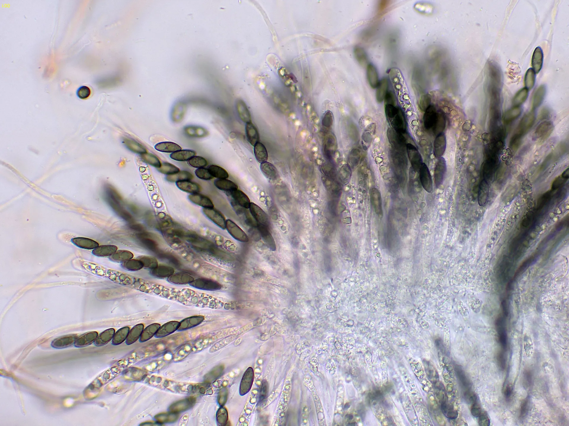 Microscopía de Rosellinia hyalospora - 13 - Himenio x 400-001